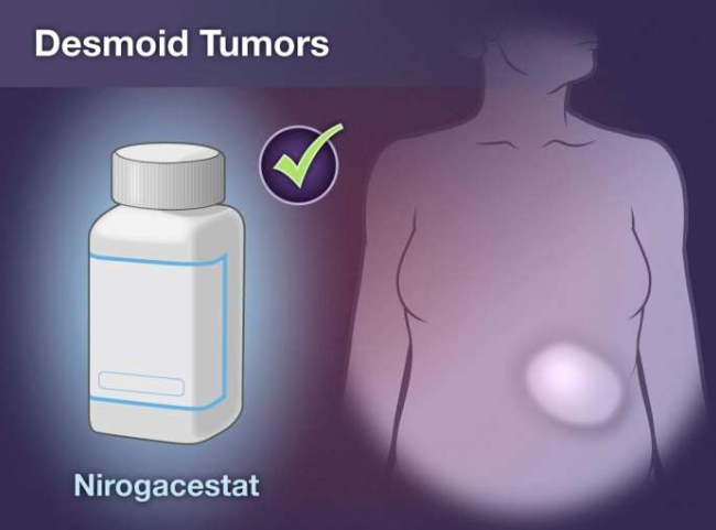 硬纤维瘤新药：nirogacestat可能为硬纤维瘤患者带来希望